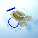 Fistula Wound Management System