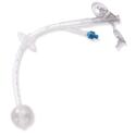 Feeding Tube Replacement