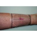 Ib Disposable Wound Measurement Guide