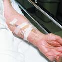 3m™ Durapore™ Surgical Tape