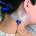Tegaderm Iv Dressing Transparent 3.5x4.25