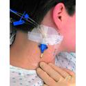 3m™ Tegaderm™ Transparent Film Dressing